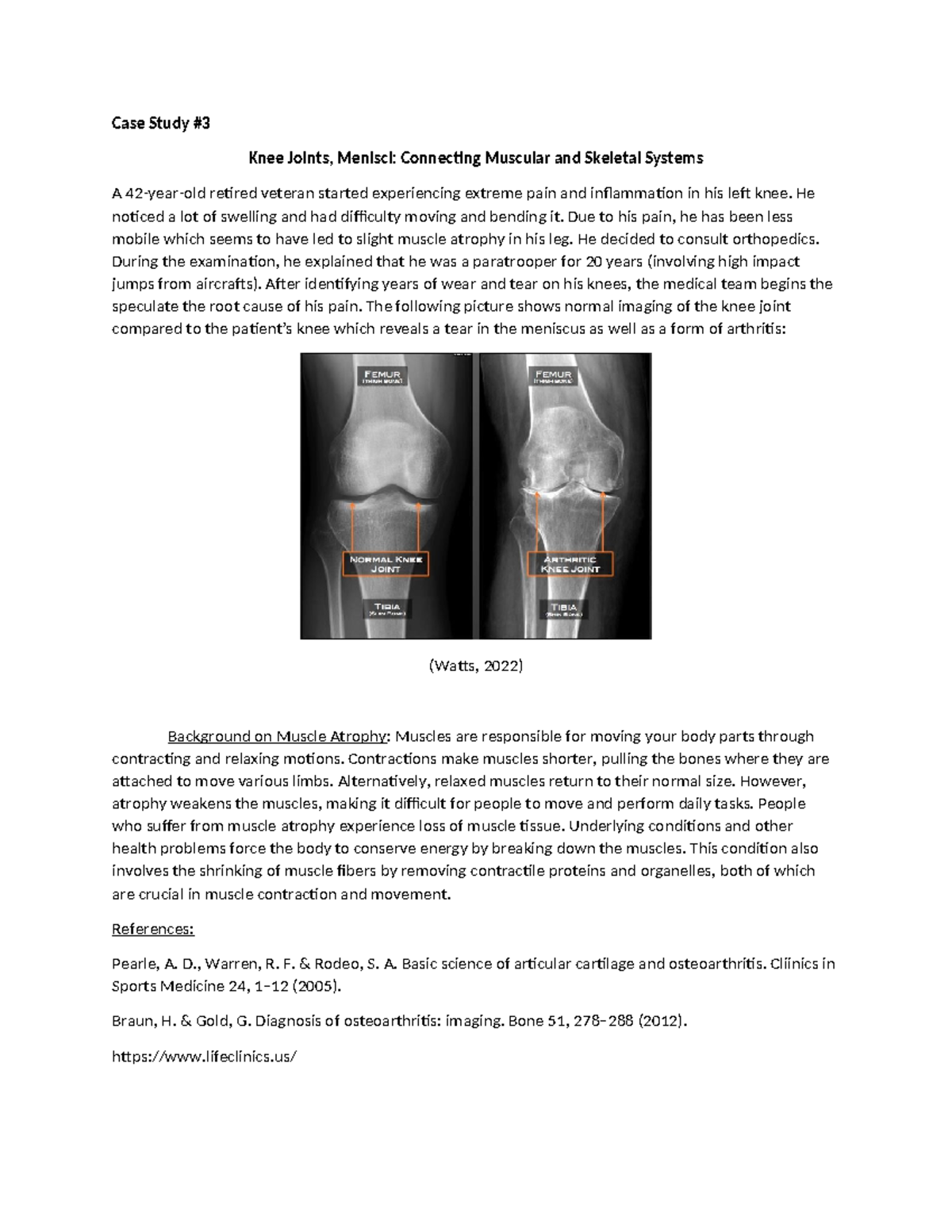 Case Study 3 Assignment Case Study Knee Joints, Menisci Connecting Muscular and Skeletal