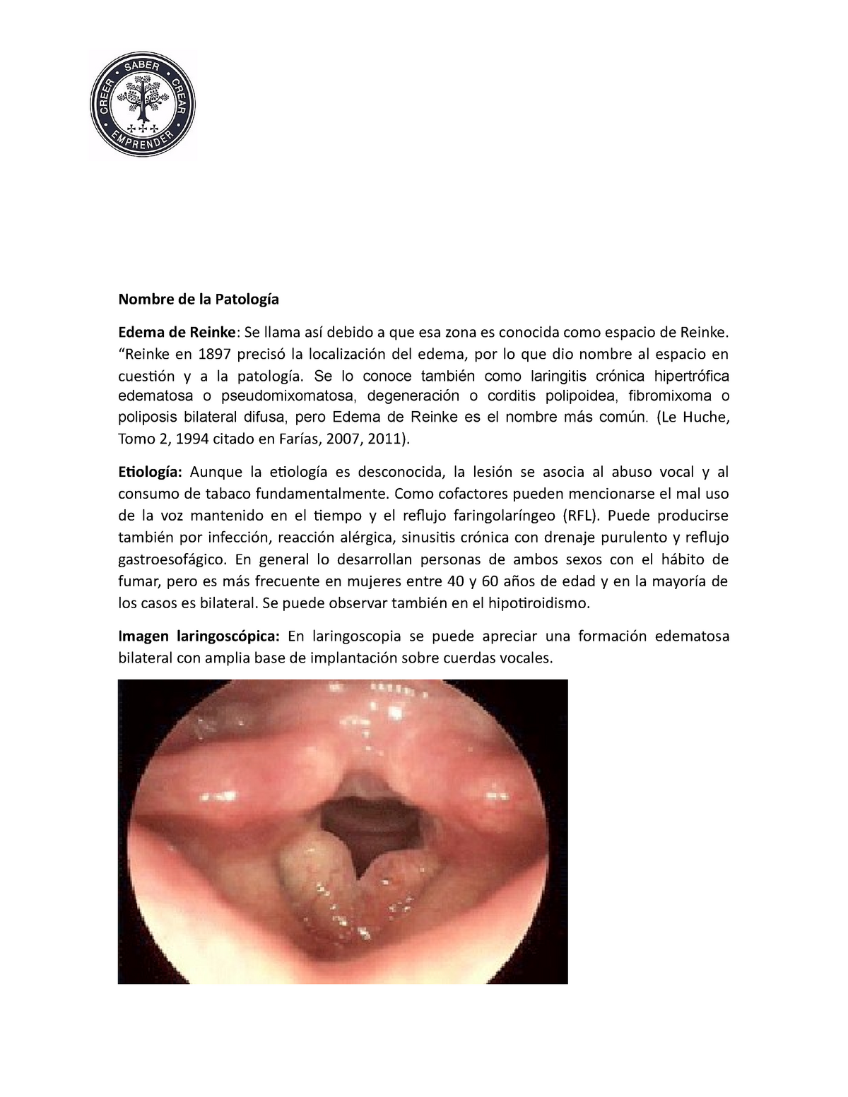 Edema DE Reinke Nombre de la Patología Edema de Reinke Se llama así