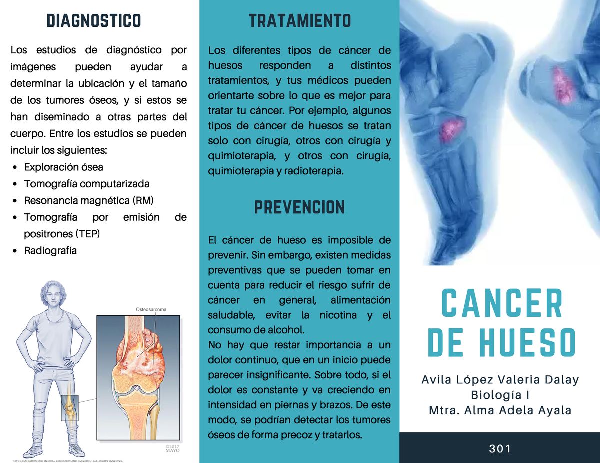 Tripticobio Tríptico Cáncer De Hueso Cancer De Hueso Avila López Valeria Dalay Biología I 