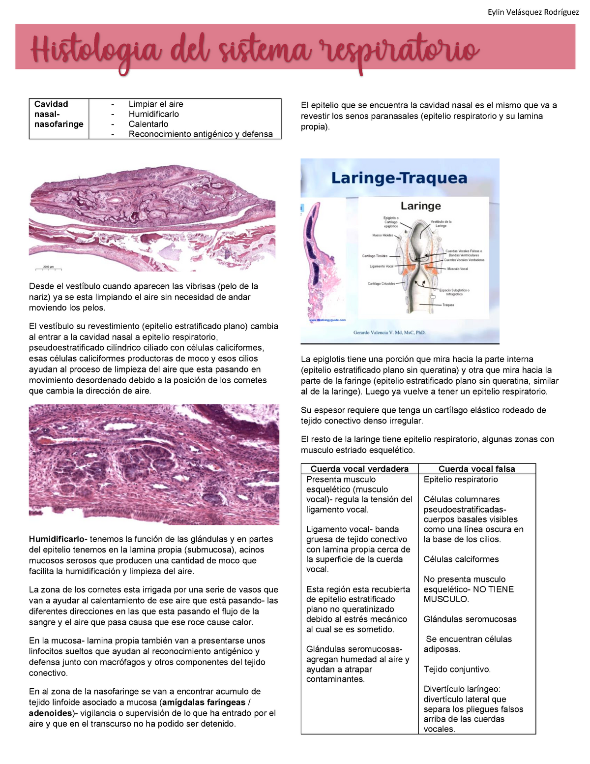 histología de las amígdalas faríngeas