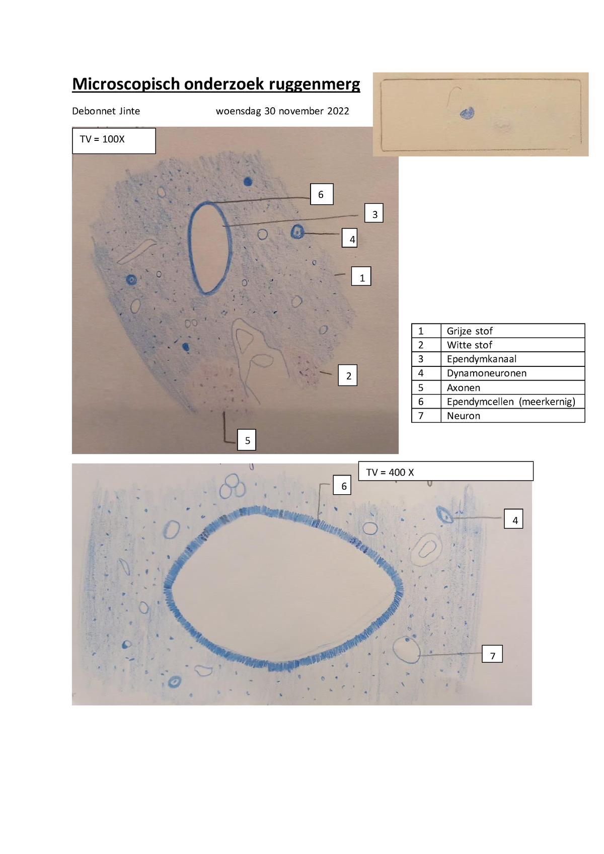 Debonnet Jinte Tekeningen Zenuwstelsel 1BLTA 30 November 2022 - Labo ...