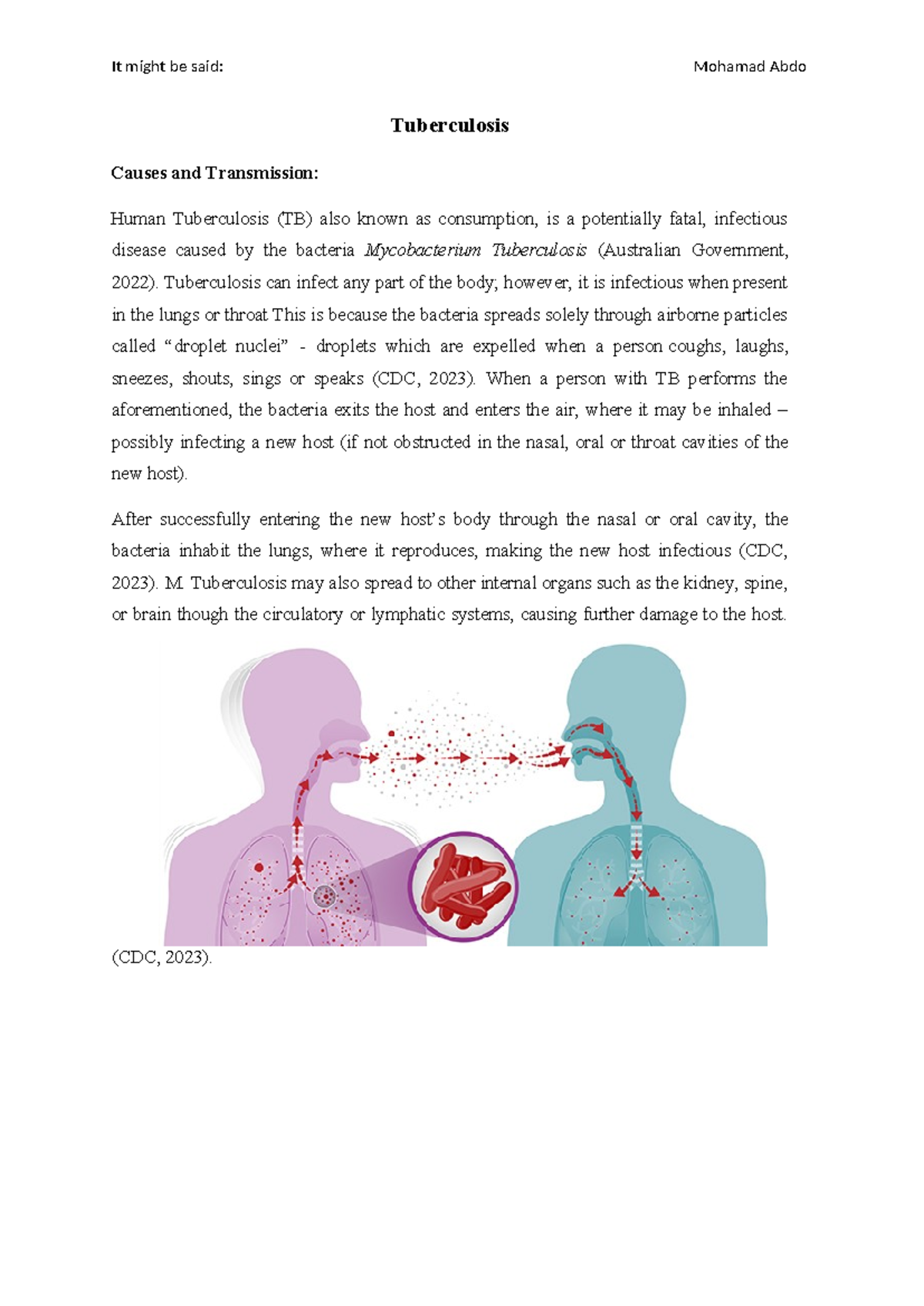 Tuberculosis - Tuberculosis can infect any part of the body; however ...