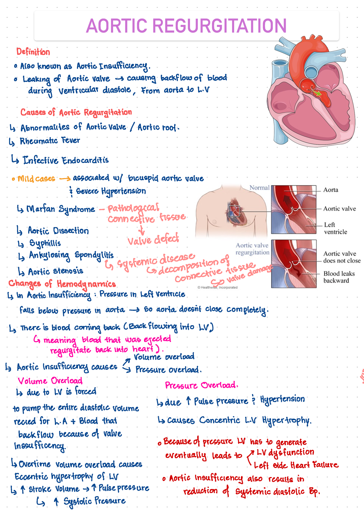 aortic-regurgitation-cardiology-aortic-regurgitation-definition-0