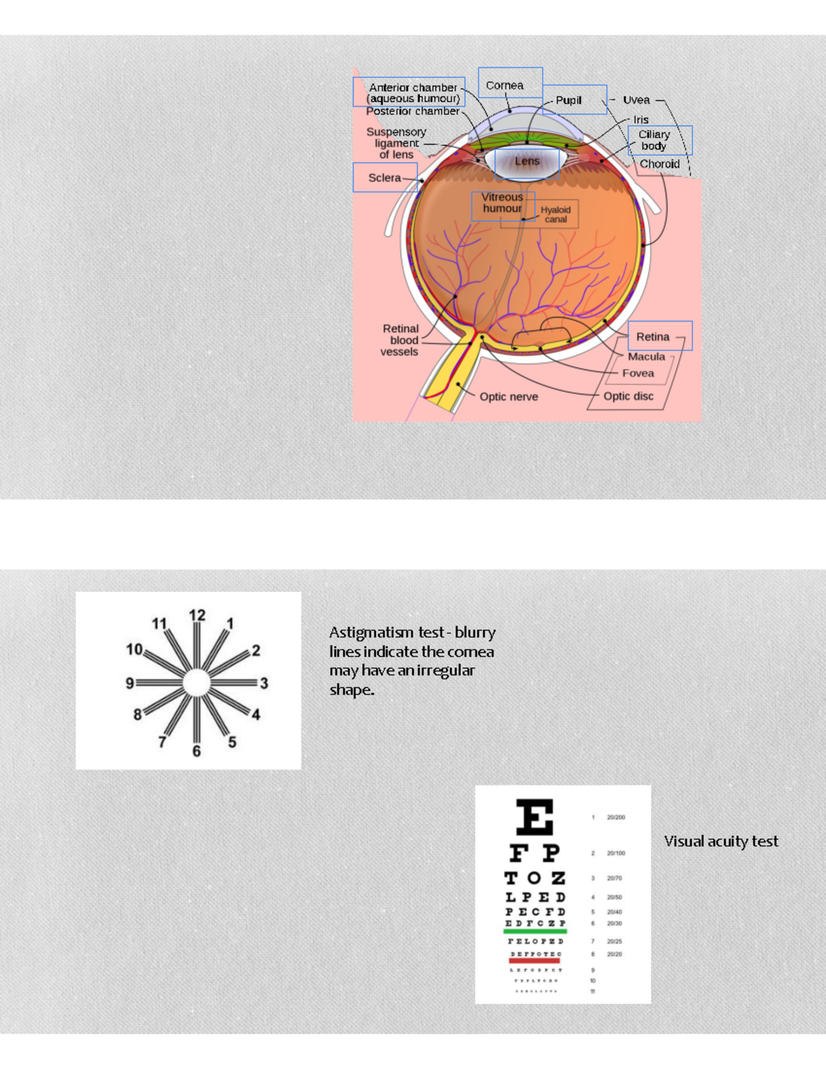 Sense organs and skeletal system lab topics - Astigmatism test - blurry ...