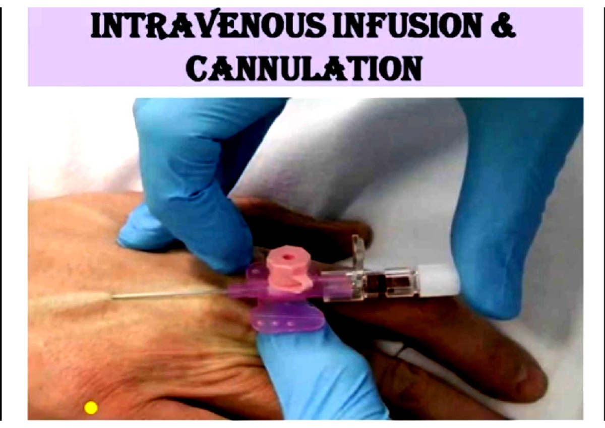 Cannulation - Nursing - Studocu