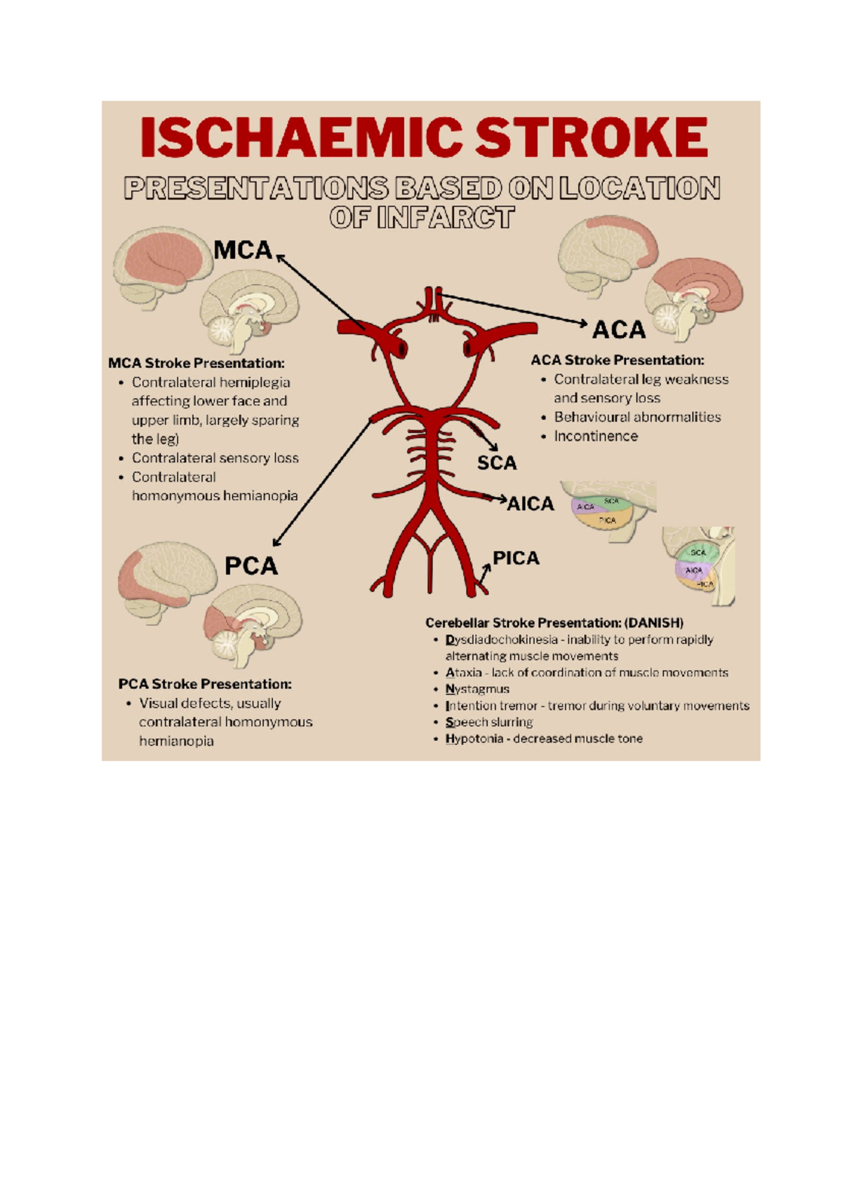 Ischaemic Stroke Cheat Sheet - ISCHAEMIC STROKE PRESENTATIONS BASED ...