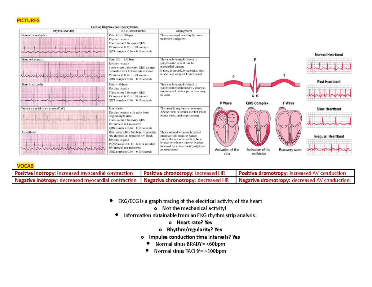 Cardiac Dysrhythmias Study Chart Pictures Vocab Positive Inotropy