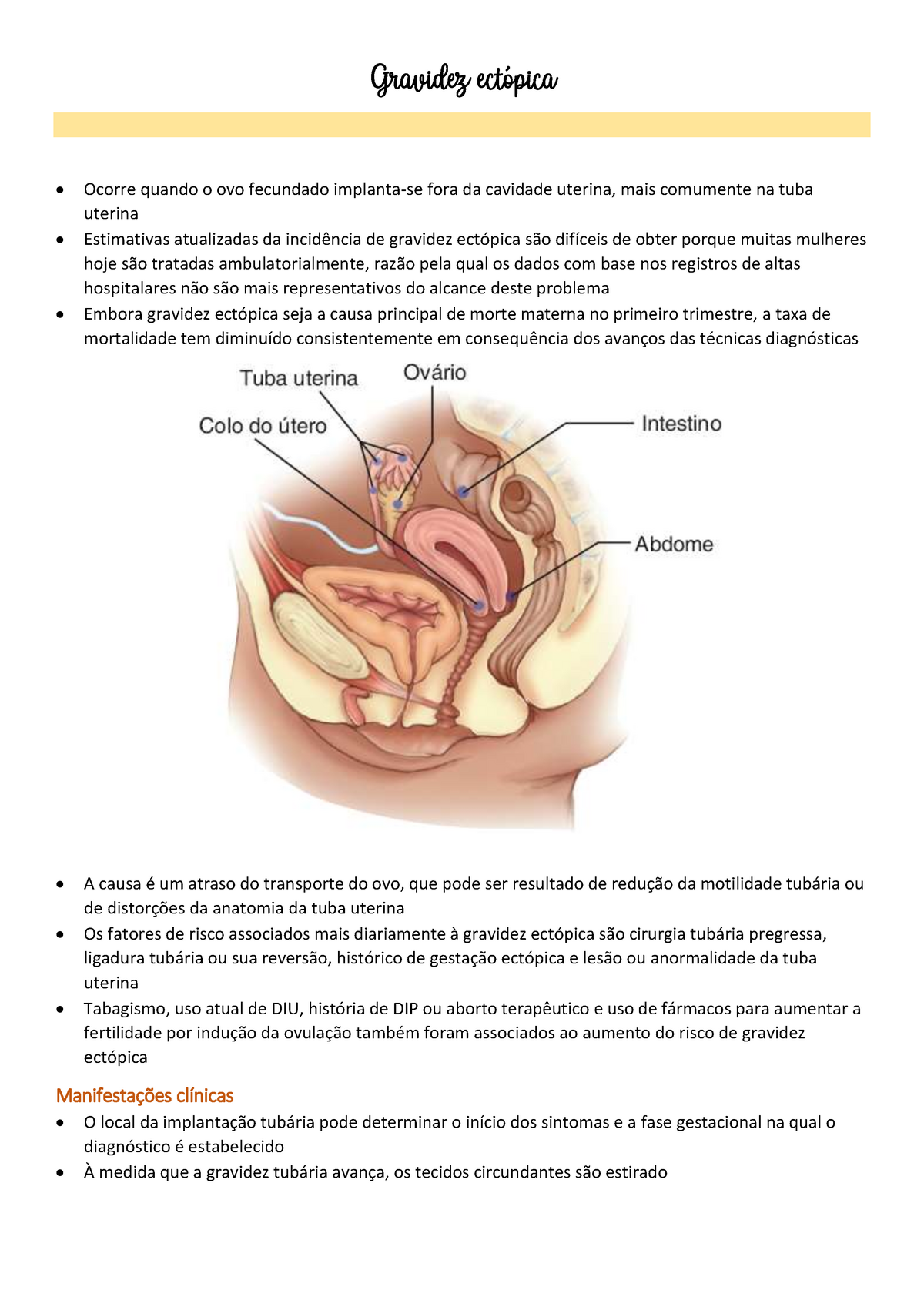 Resumo sobre gravidez ectópica