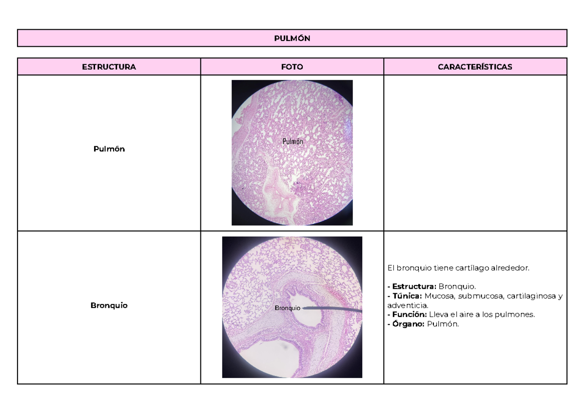 PulmóN - PRÁ Ctica - Histologia de pulmón, placas - PULMÓN ESTRUCTURA ...