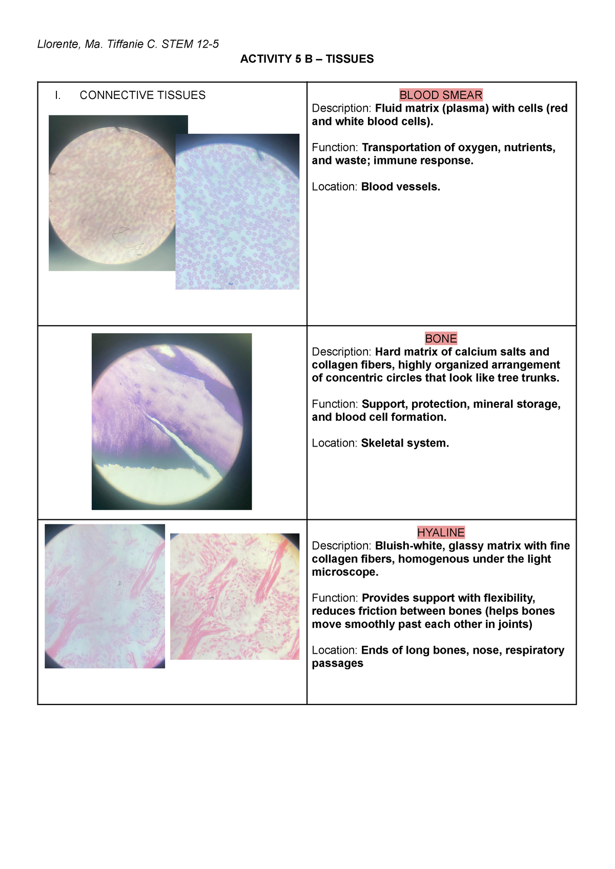 Activity 5 B – Tissues - Llorente, Ma. Tiffanie C. STEM 12- ACTIVITY 5 ...