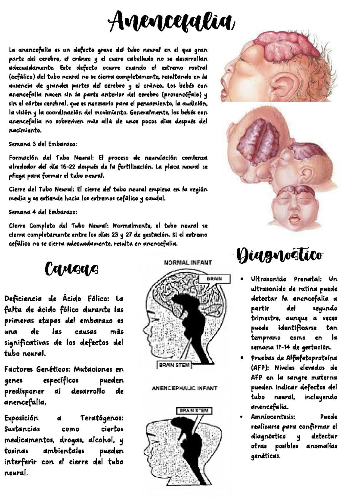 ANENcefalia EMBRIOLOGIA - Anencefalia La anencefalia es un defecto ...