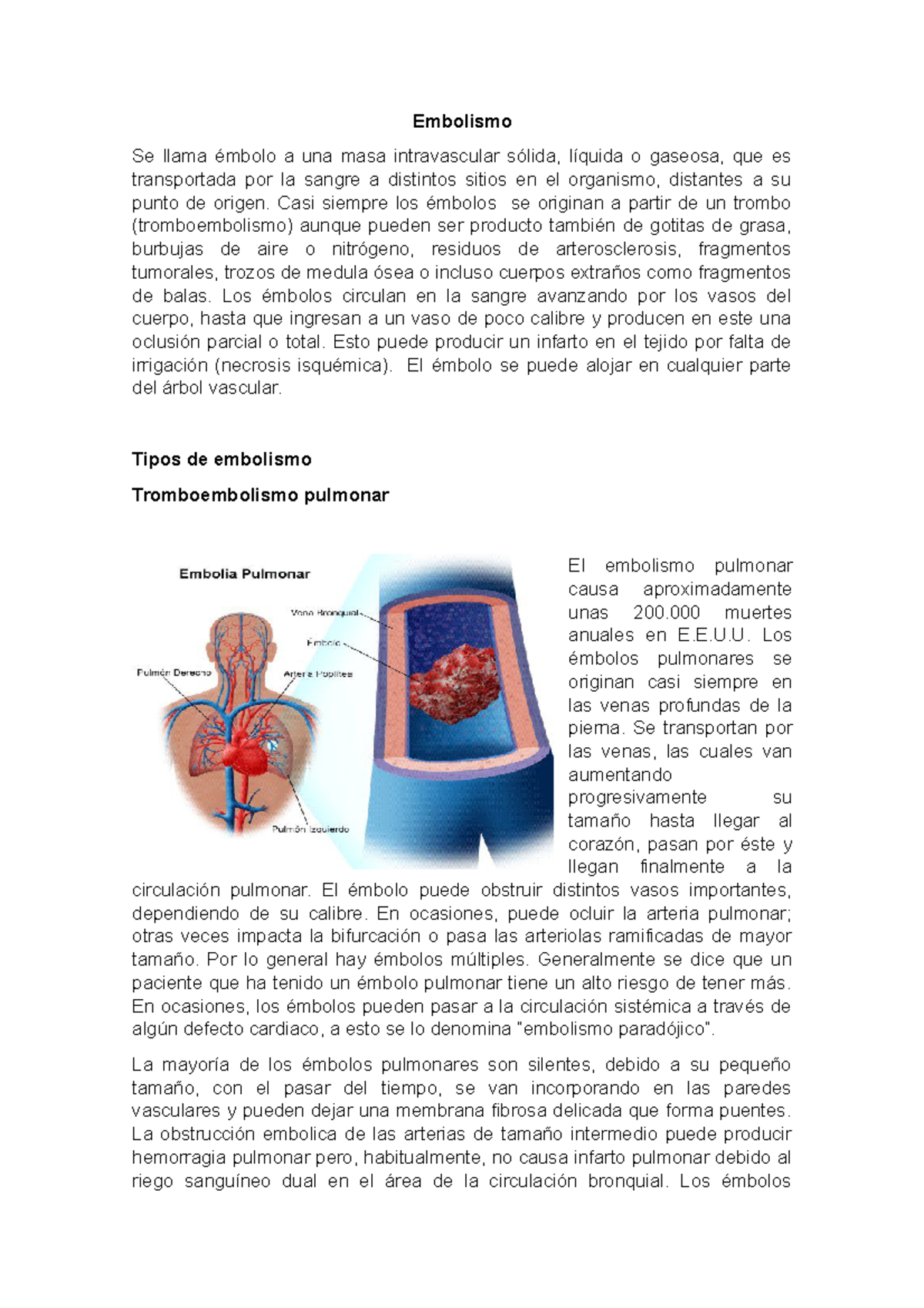 Embolismo - Embolismo Se llama émbolo a una masa intravascular sólida ...