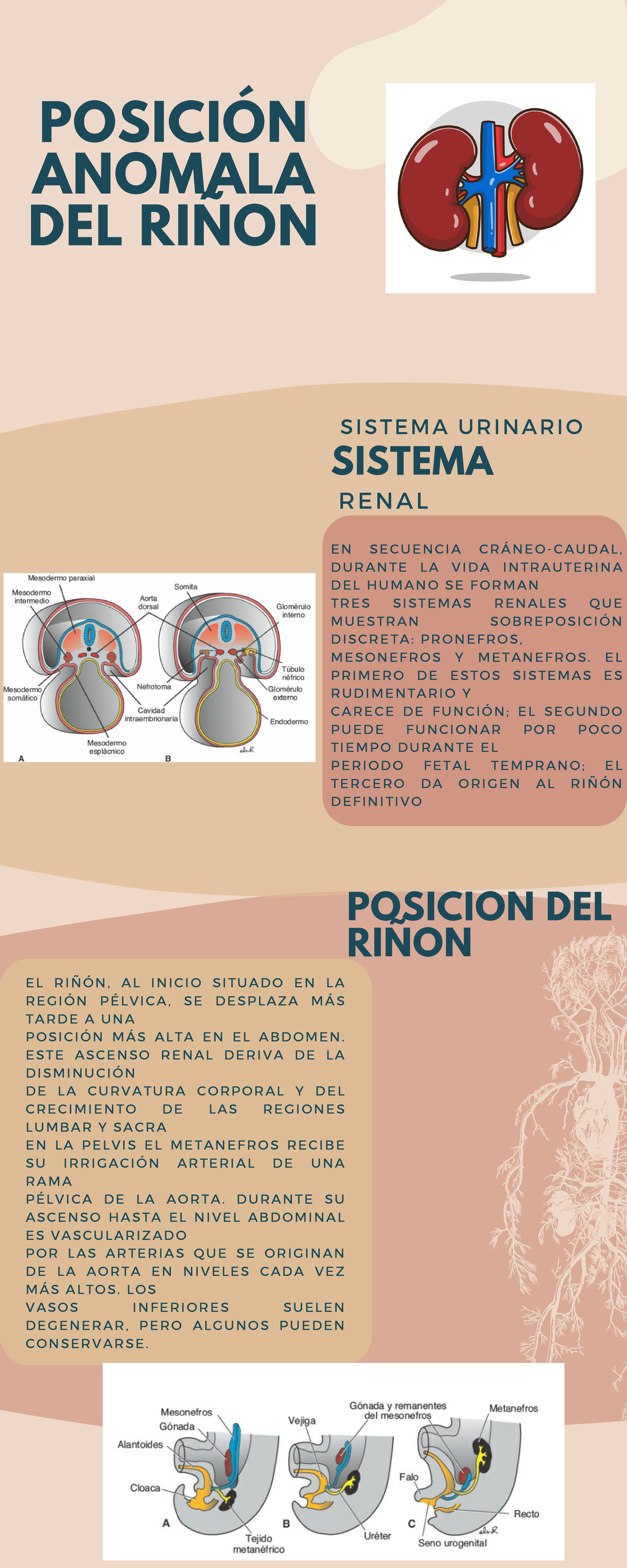 Posiciones anormales del riñon - POSICION DEL RIÑON SISTEMA S I S T E M ...