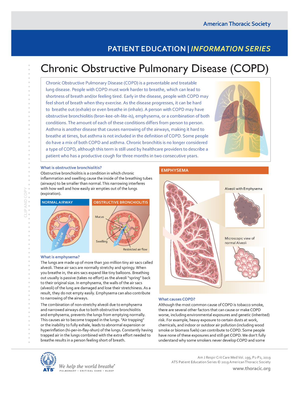 american-thoracic-society-chronic-obstructive-pulmonary-disease-copd