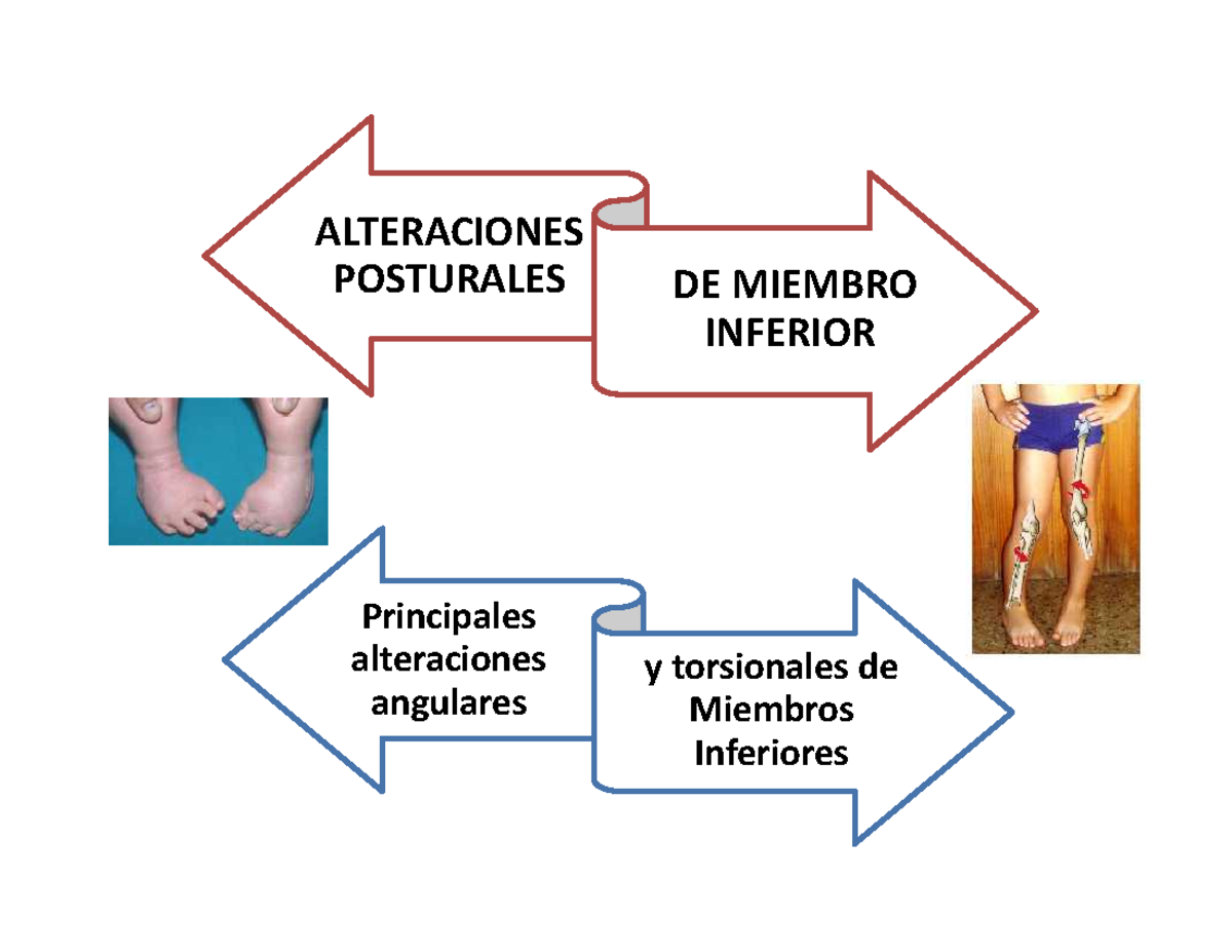 Deformaciones torsionales y angulares de miembro inferior 2015