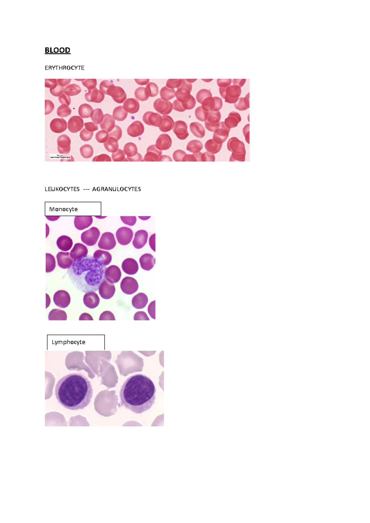 Blood - medical - BLOOD ERYTHROCYTE LEUKOCYTES - AGRANULOCYTES Monocyte ...