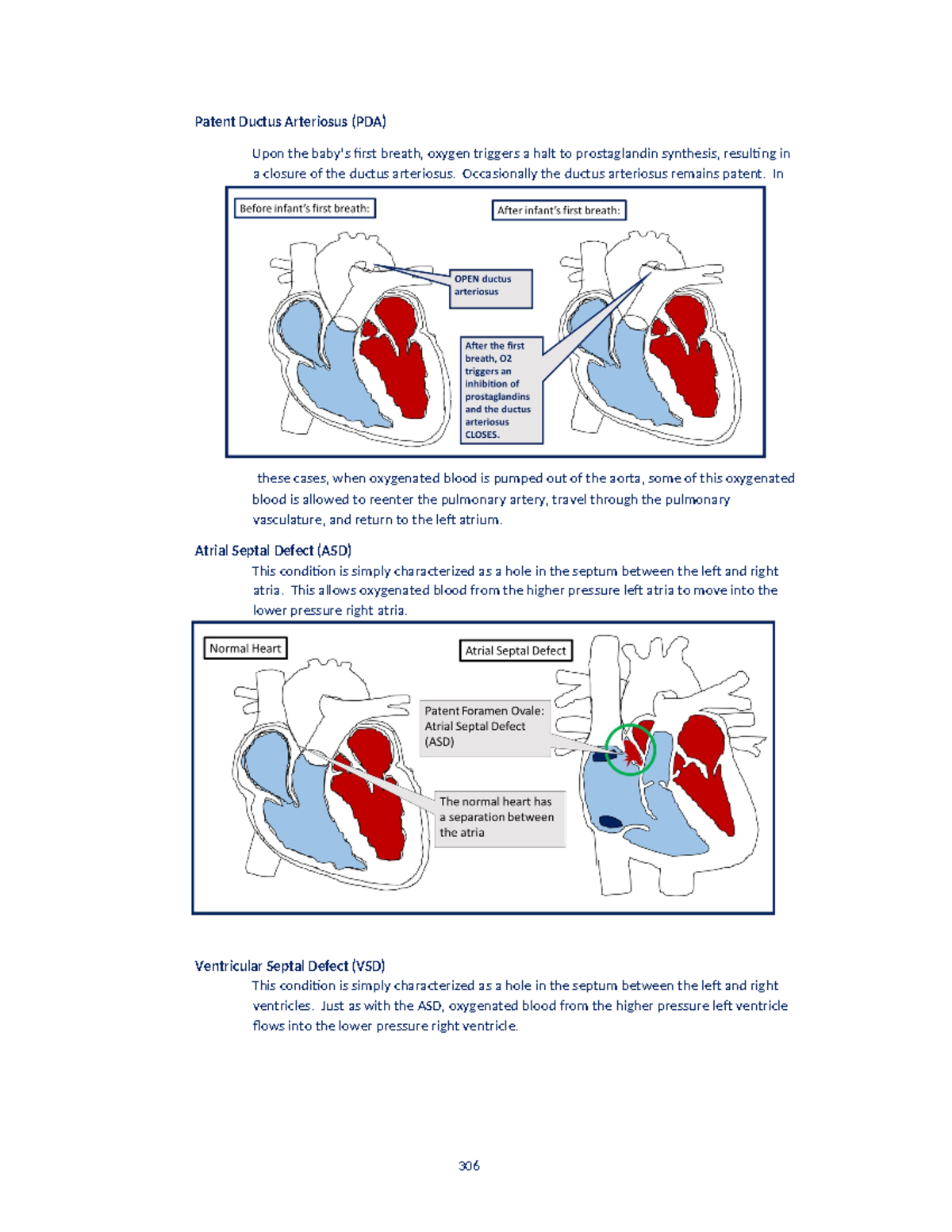 Neonatal defects example Patent Ductus Arteriosus (PDA) Upon the baby