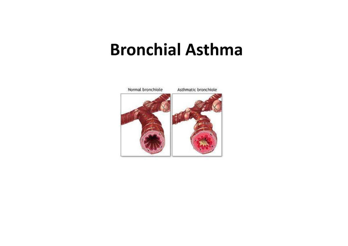 Bronchial-Asthma - Bronchial Asthama Lecture Note - Bronchial Asthma ...