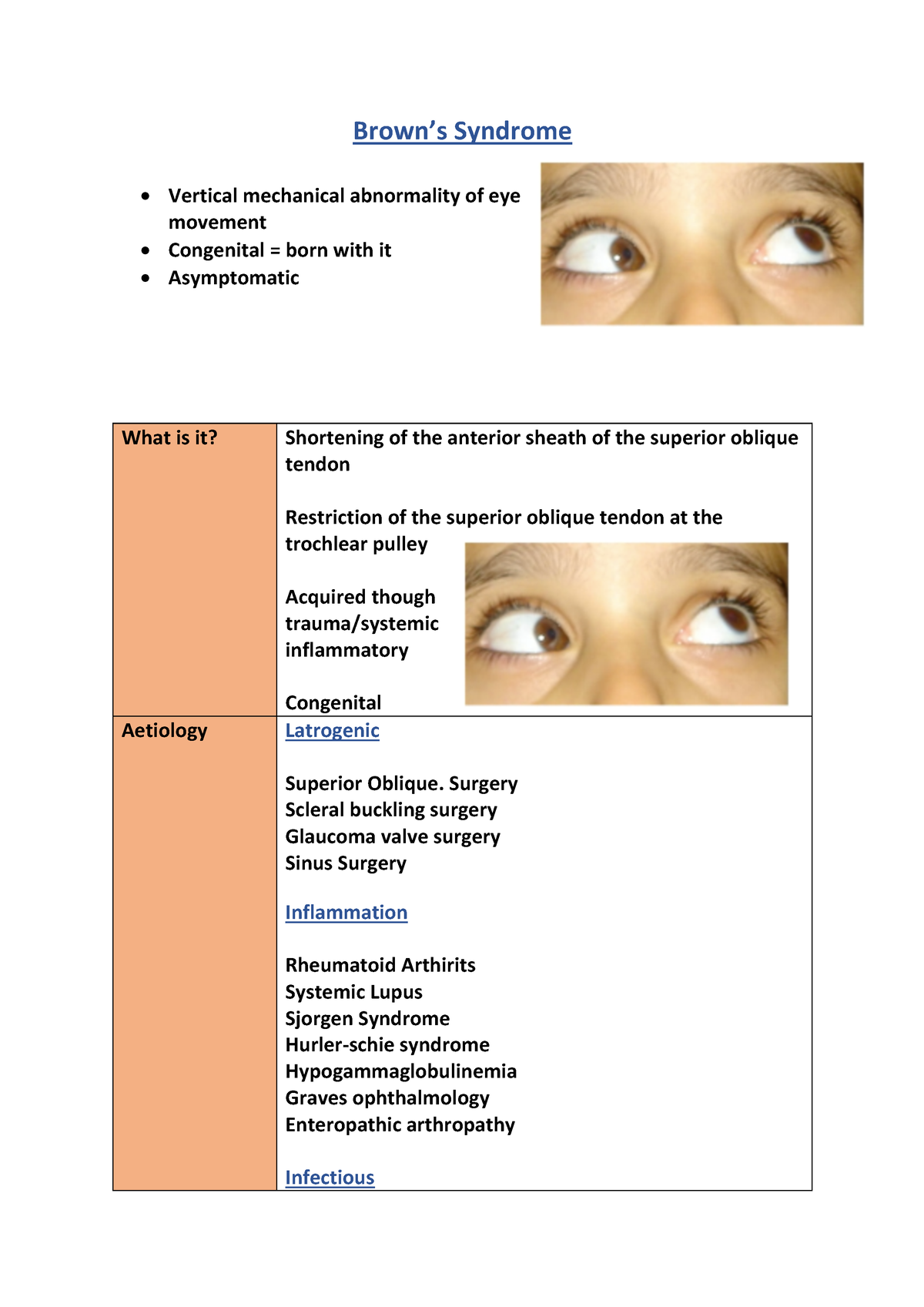 Brown Syndrome - n.a - Brown’s Syndrome Vertical mechanical abnormality ...