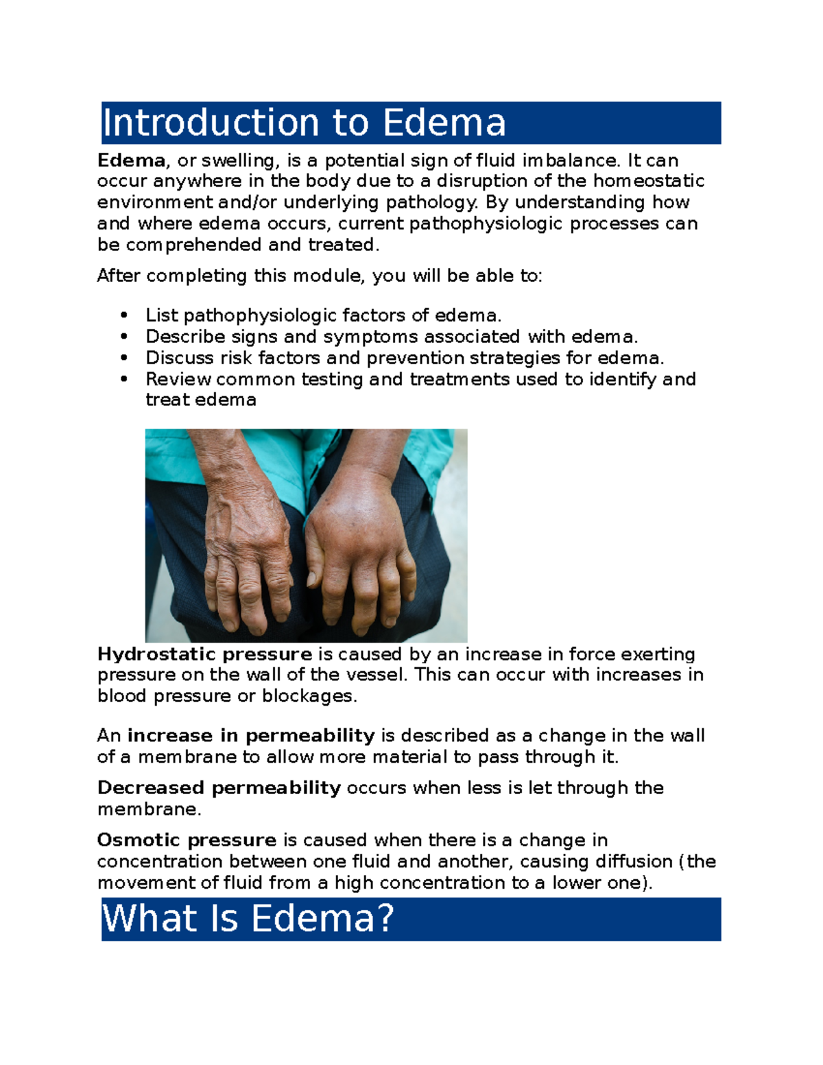 Introduction to Edema - WK5 Adapt NR283 - Introduction to Edema Edema ...