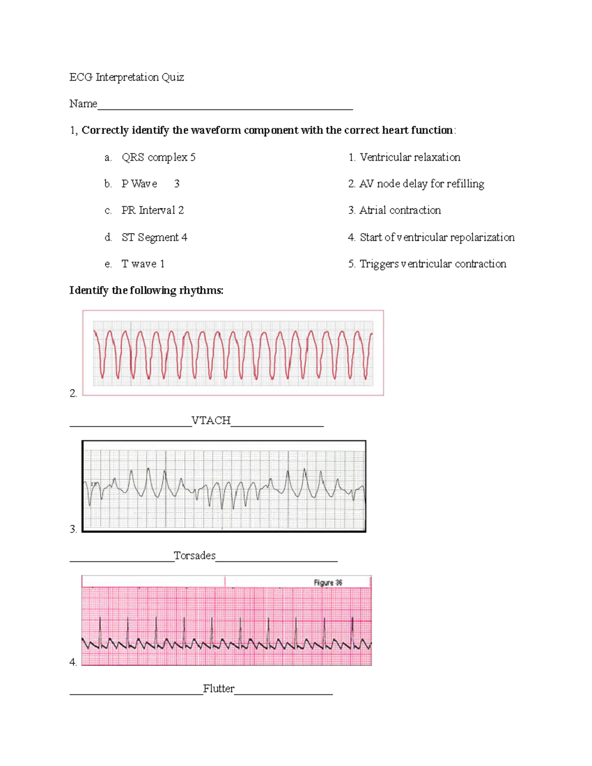 ECG Interpretation Quiz Answers - ECG Interpretation Quiz - Studocu