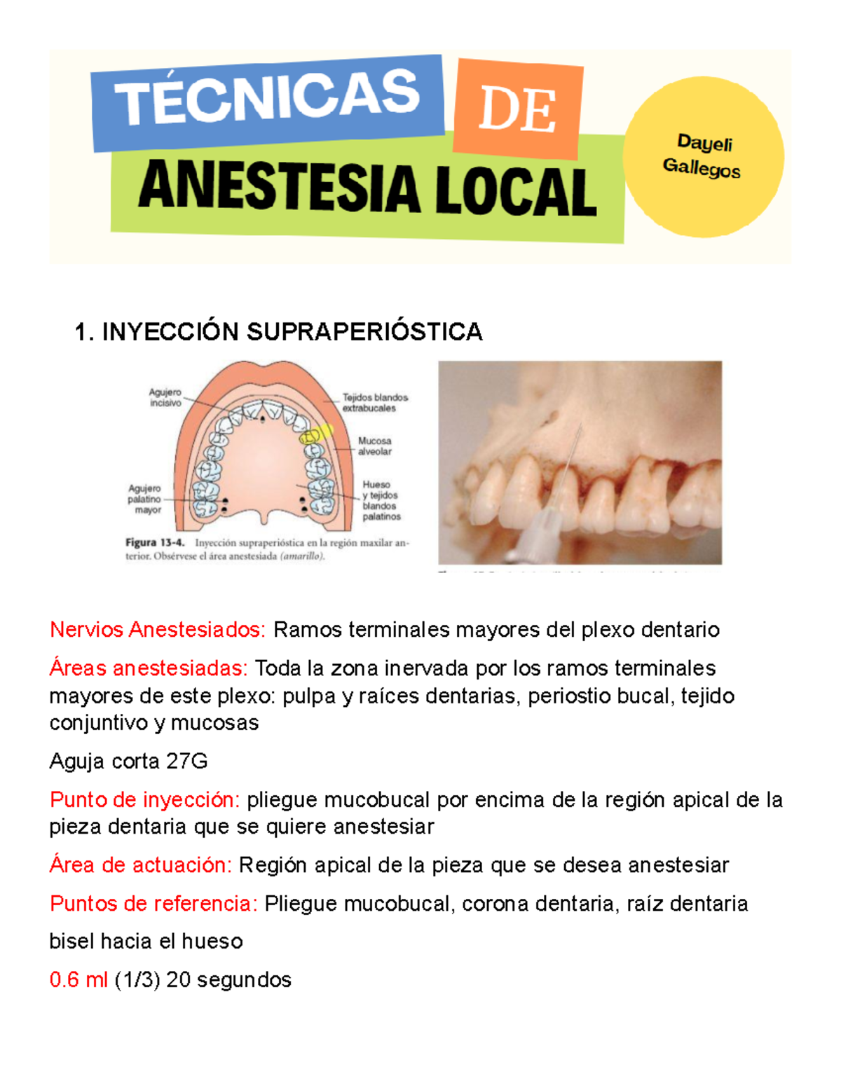 Tecnicas anestesia - 1. INYECCIÓN SUPRAPERIÓSTICA Nervios Anestesiados ...