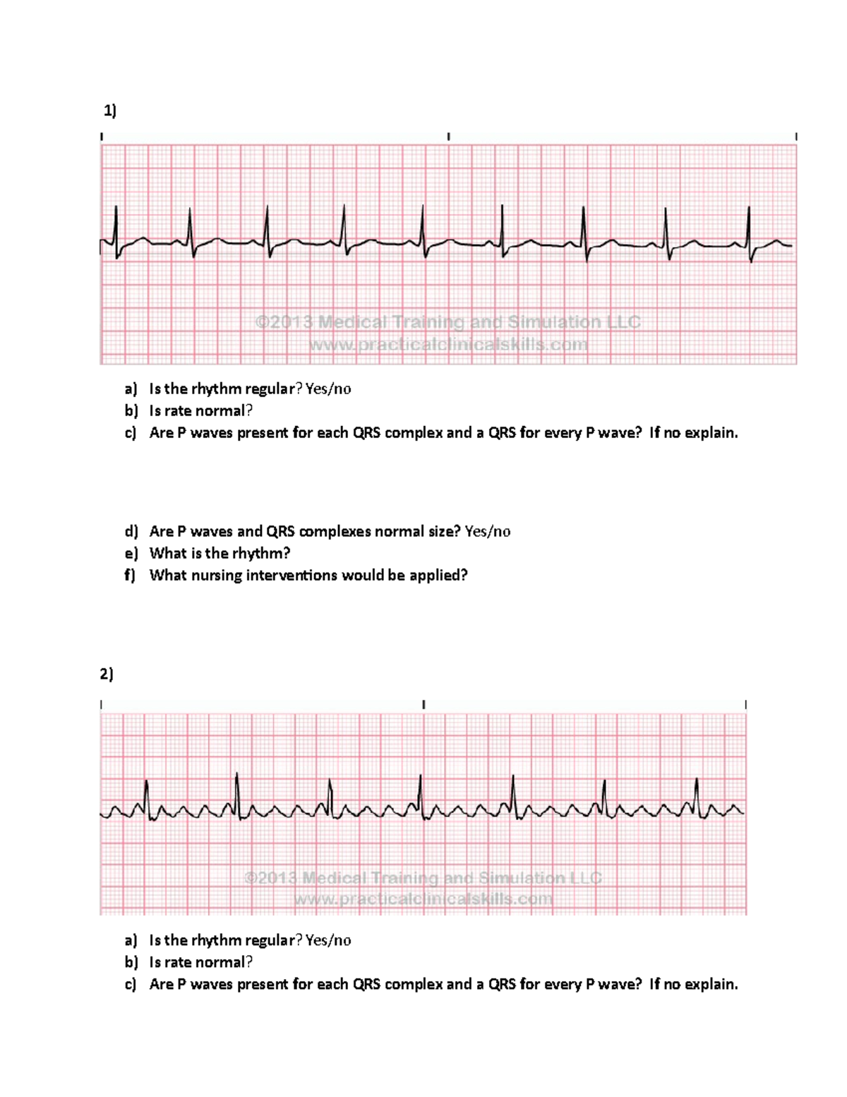 EKG practice strips - ekg - 1) a) Is the rhythm regular? Yes/no b) Is ...