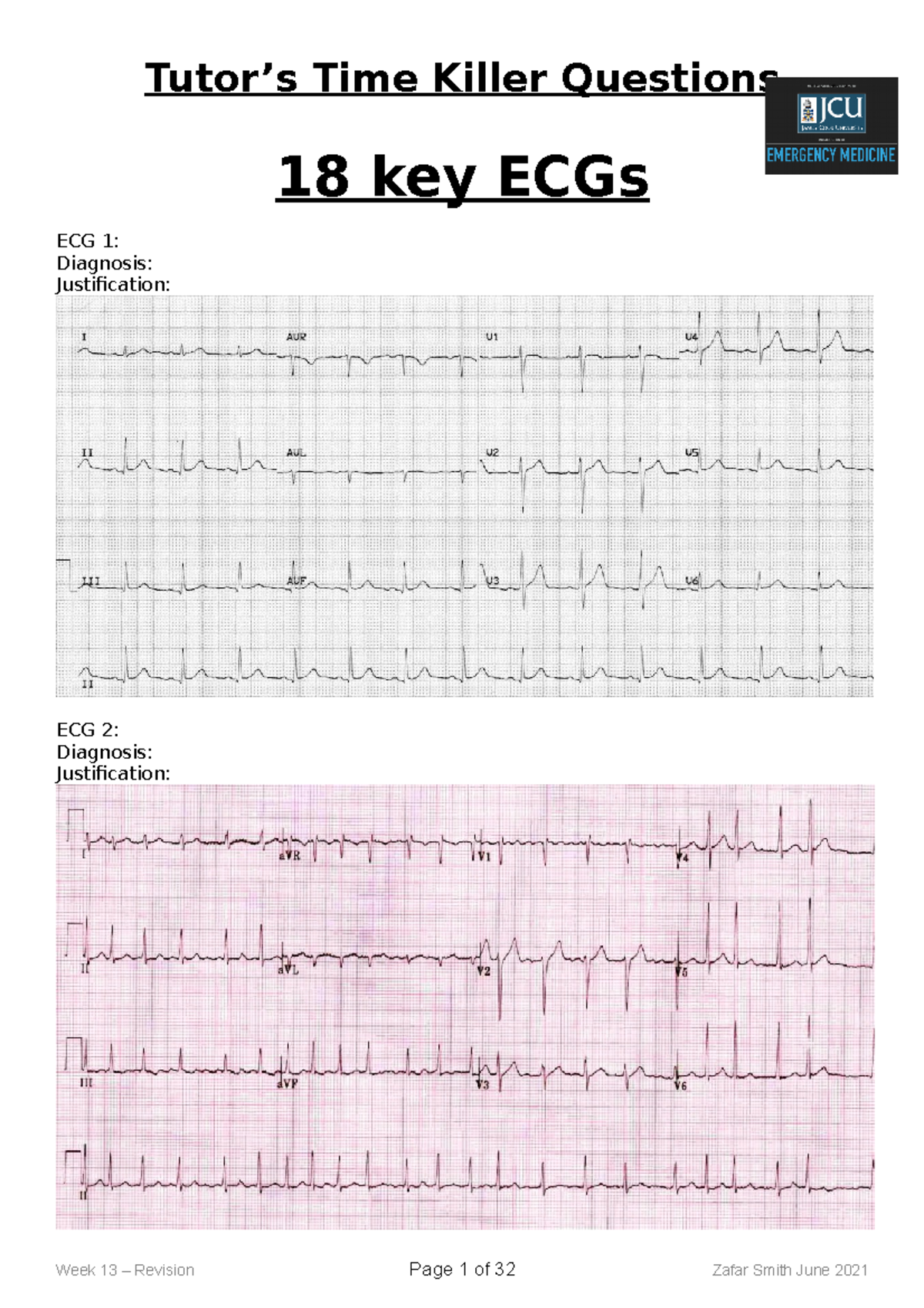 Xray and ECG practice exam questions with answers - Tutor’s Time Killer ...