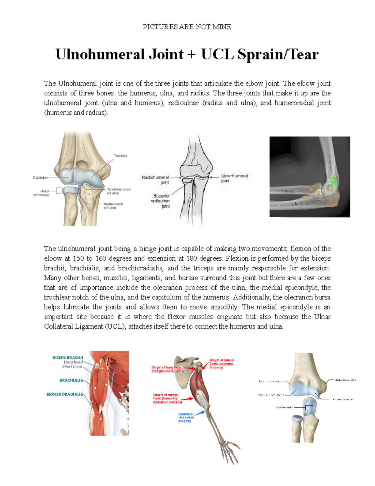 Ulnohumeral Joint + UCL Sprain Tear - The elbow joint consists of three ...