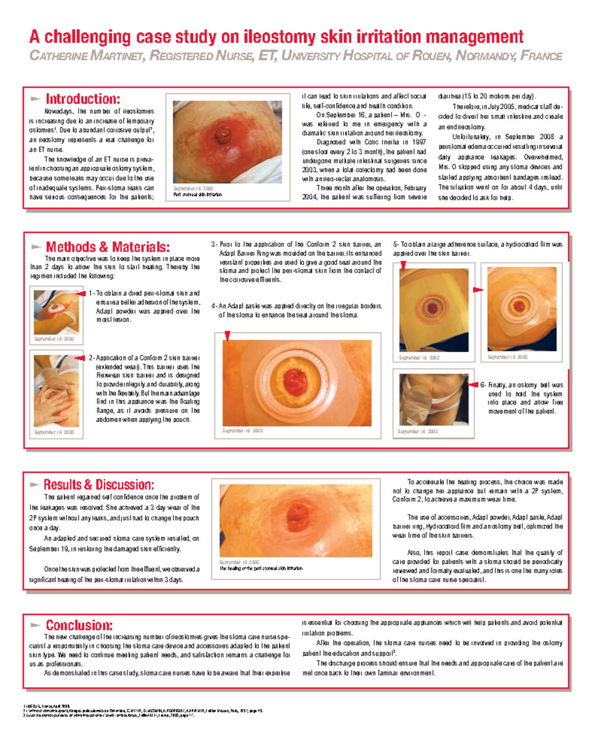 HOL OS A Challenging Case Study on Ileostomy Skin Irritation Management
