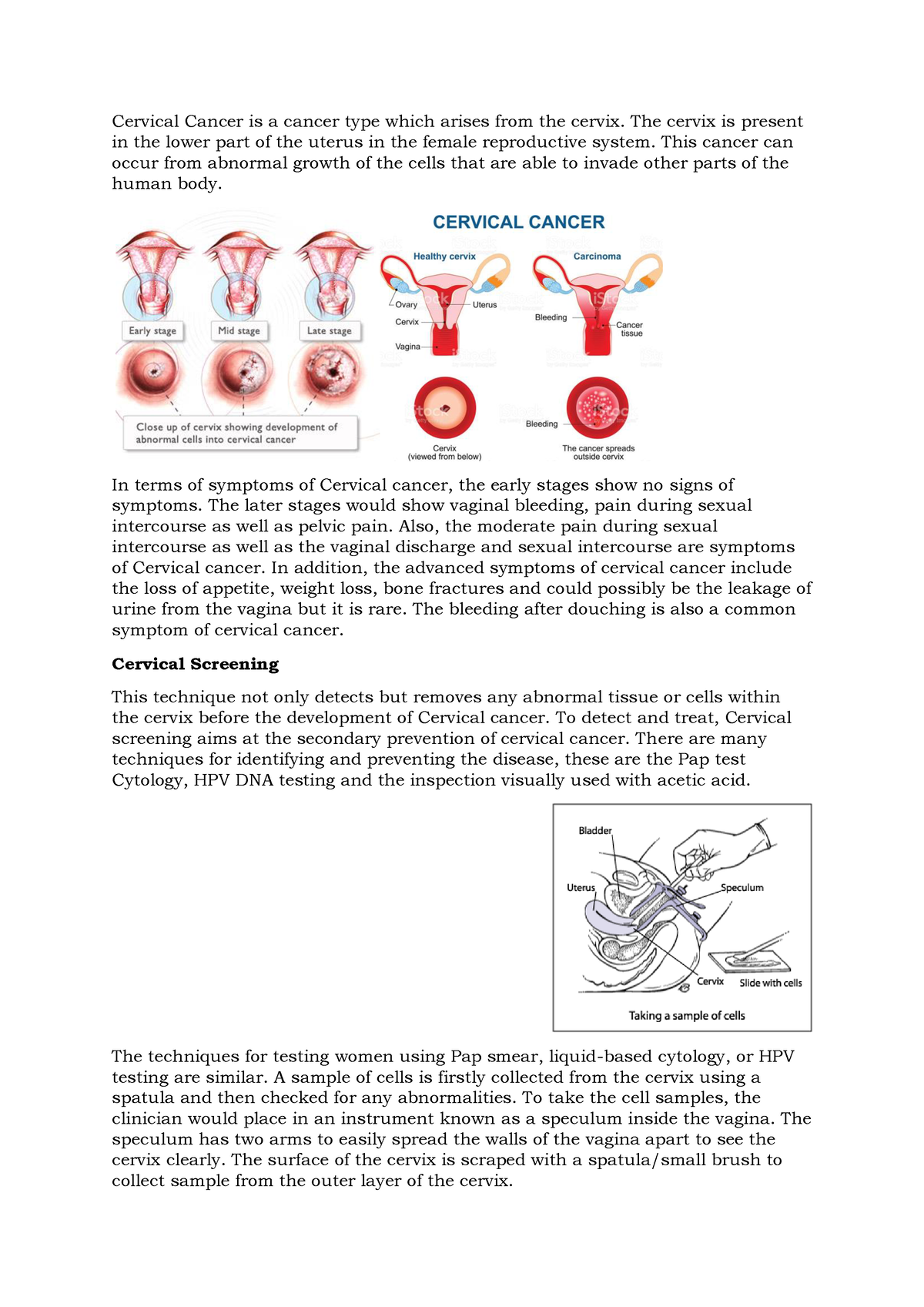 Cervical Cancer - The cervix is present in the lower part of the uterus ...