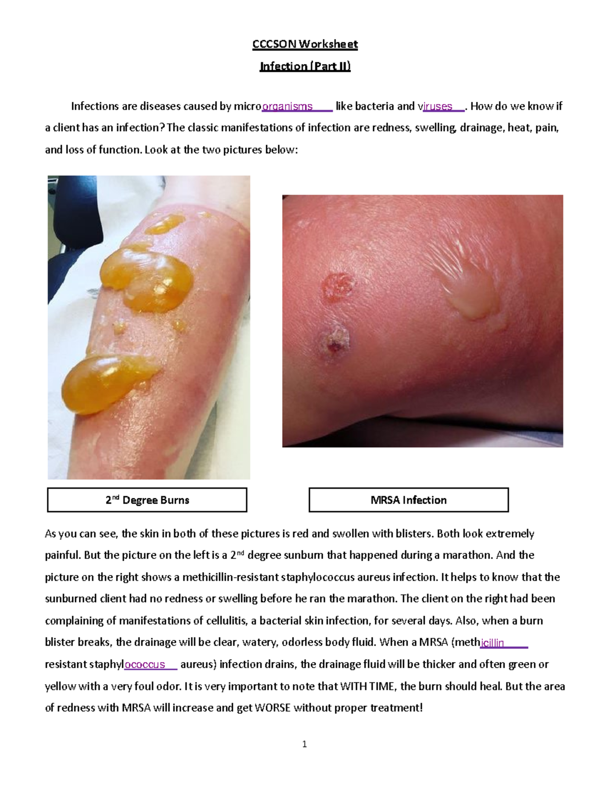 150Infection (Part II) - CCCSON Worksheet Infection (Part II ...