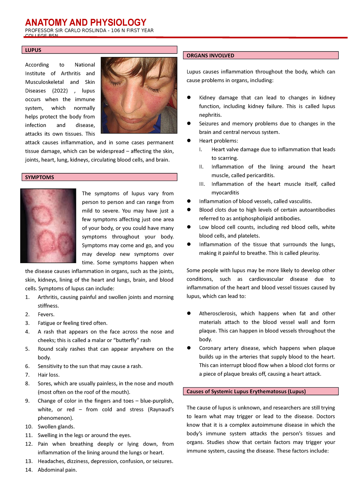 Lupus: Symptoms and Organs - ANATOMY AND PHYSIOLOGY PROFESSOR SIR CARLO ...