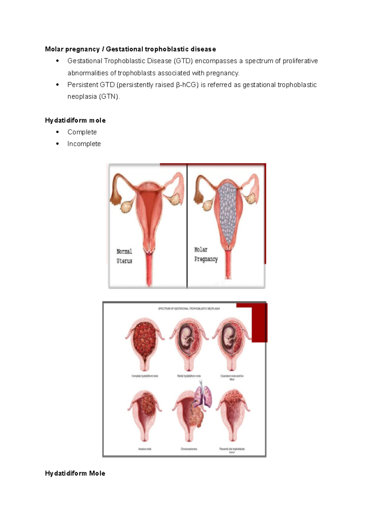 molar-p-summary-gynaecology-by-ten-teachers-molar-pregnancy