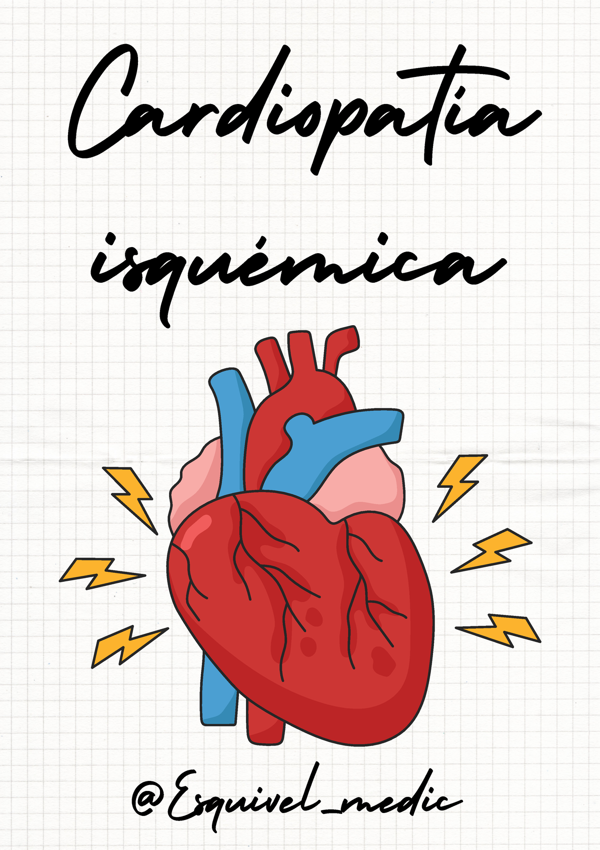 @Cardiopatía Isquémica - Cardiopatía Isquémica @Esquivel_medic La ...