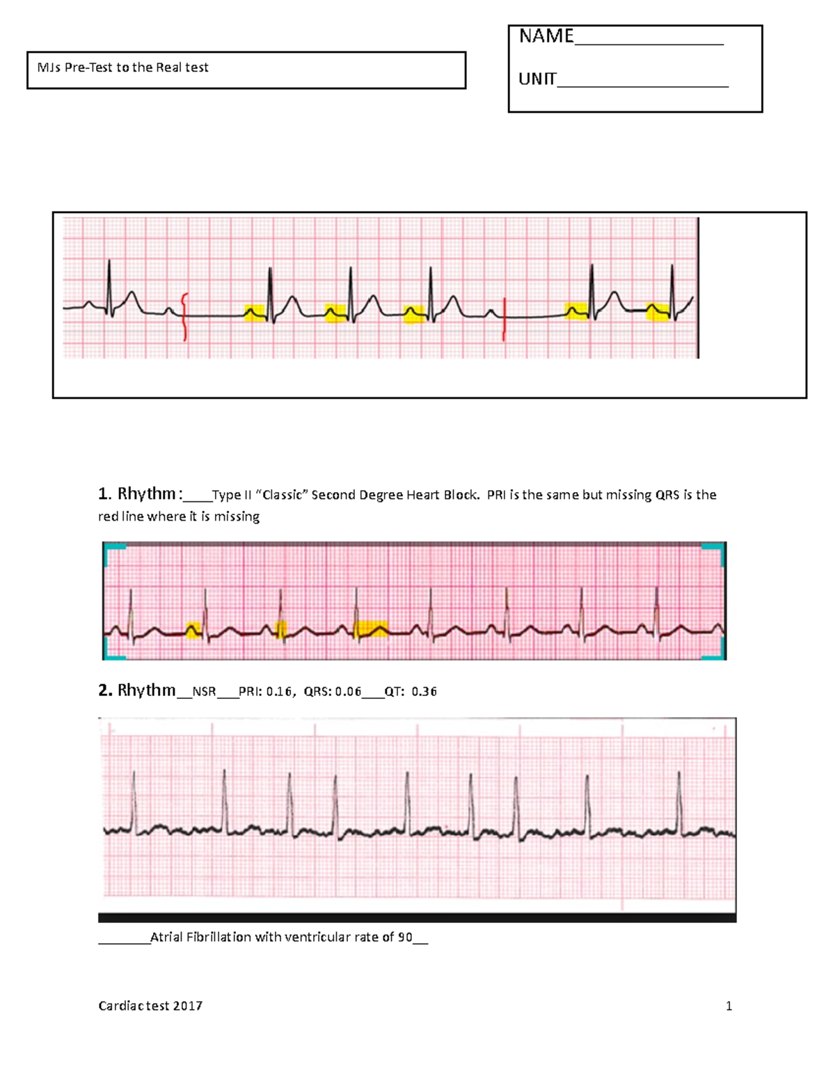 2020-pre test to arrhythmia test - 1. Rhythm:____Type II “Classic ...