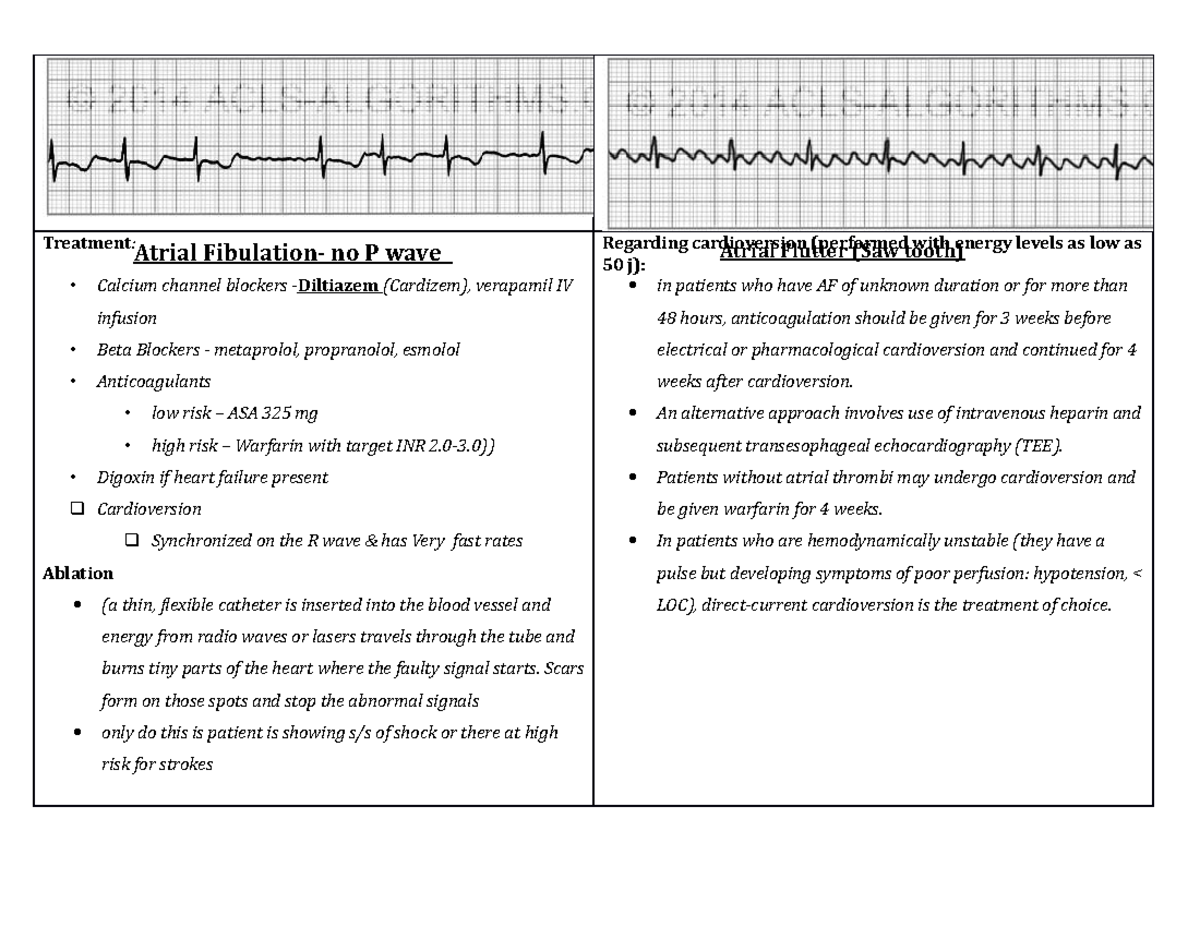 Cardiac Charts - Treatment: Atrial Fibulation- no P wave • Calcium ...