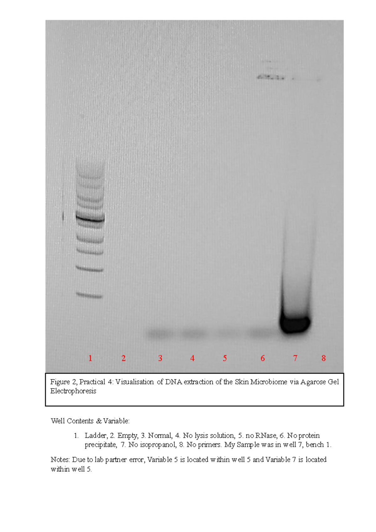 Figure 2 - 091132 - Figure 2 , Practical 4 : Visualisation of DNA ...