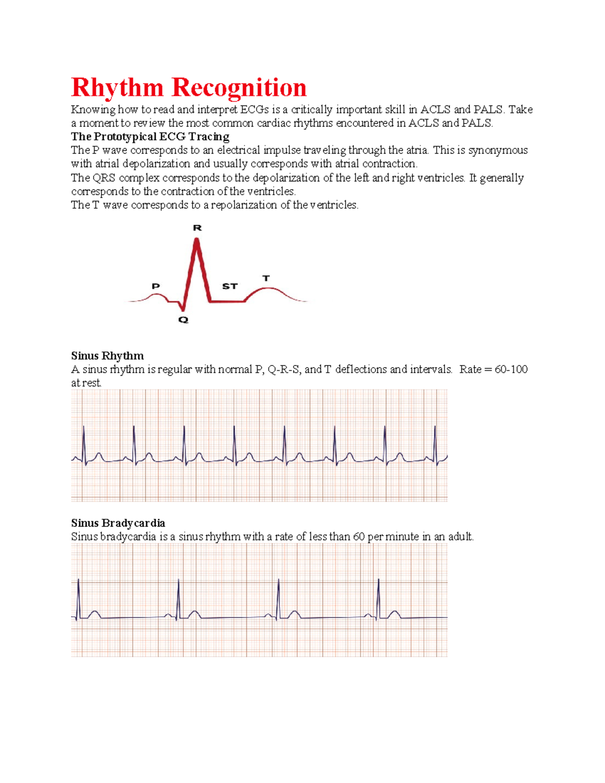 Rhythm Recognition - notes - Rhythm Recognition Knowing how to read and ...
