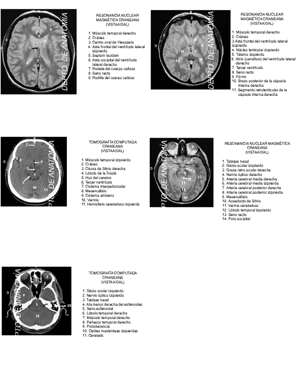 cd-neuro-y-anato-cds-1-9-7-8-6-5-3-resonancia-nuclear-magn-tica