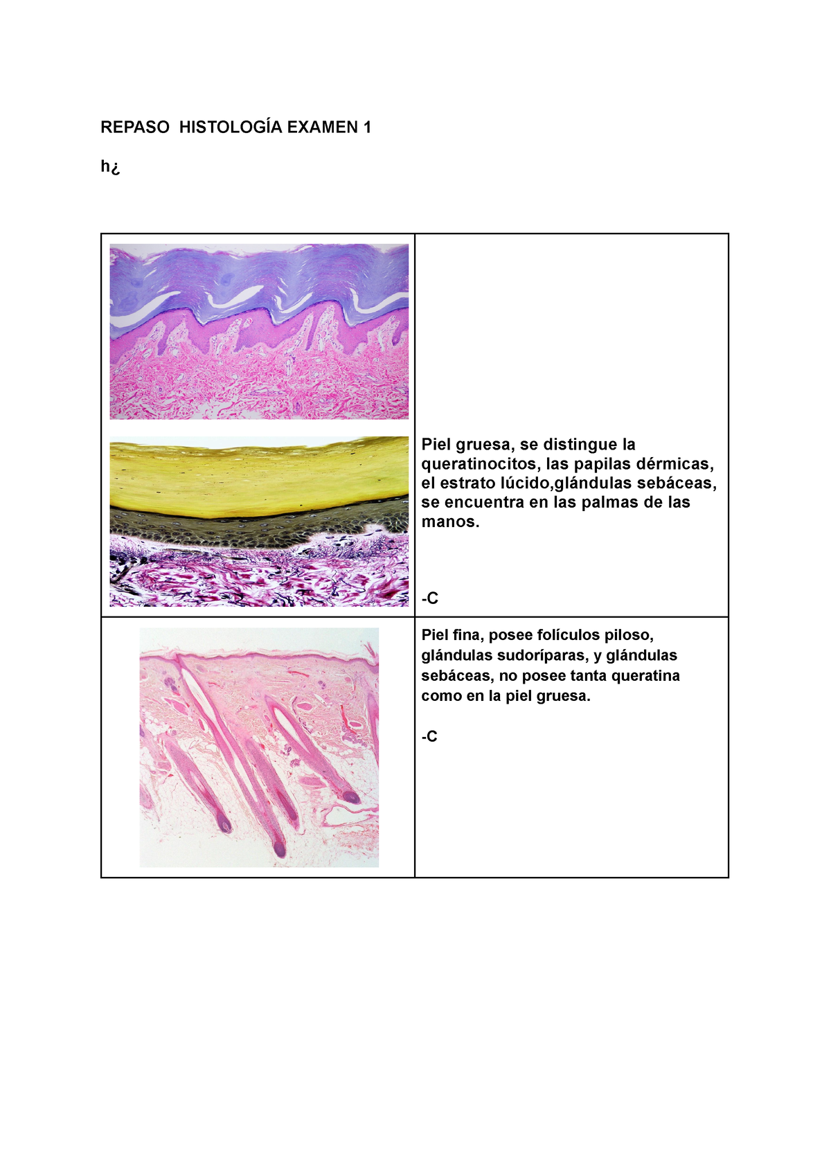 Repaso Histologia Examen 1 - REPASO HISTOLOGÍA EXAMEN 1 H¿ Piel Gruesa ...