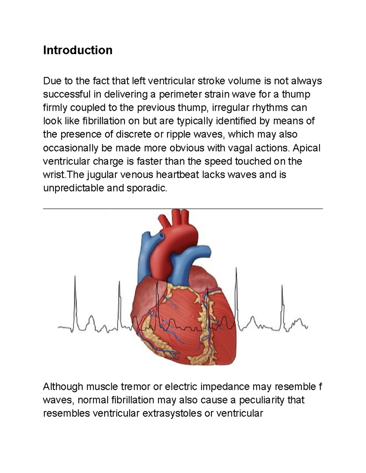 Atrial Fibrillation - A detailed description about the etiology ...