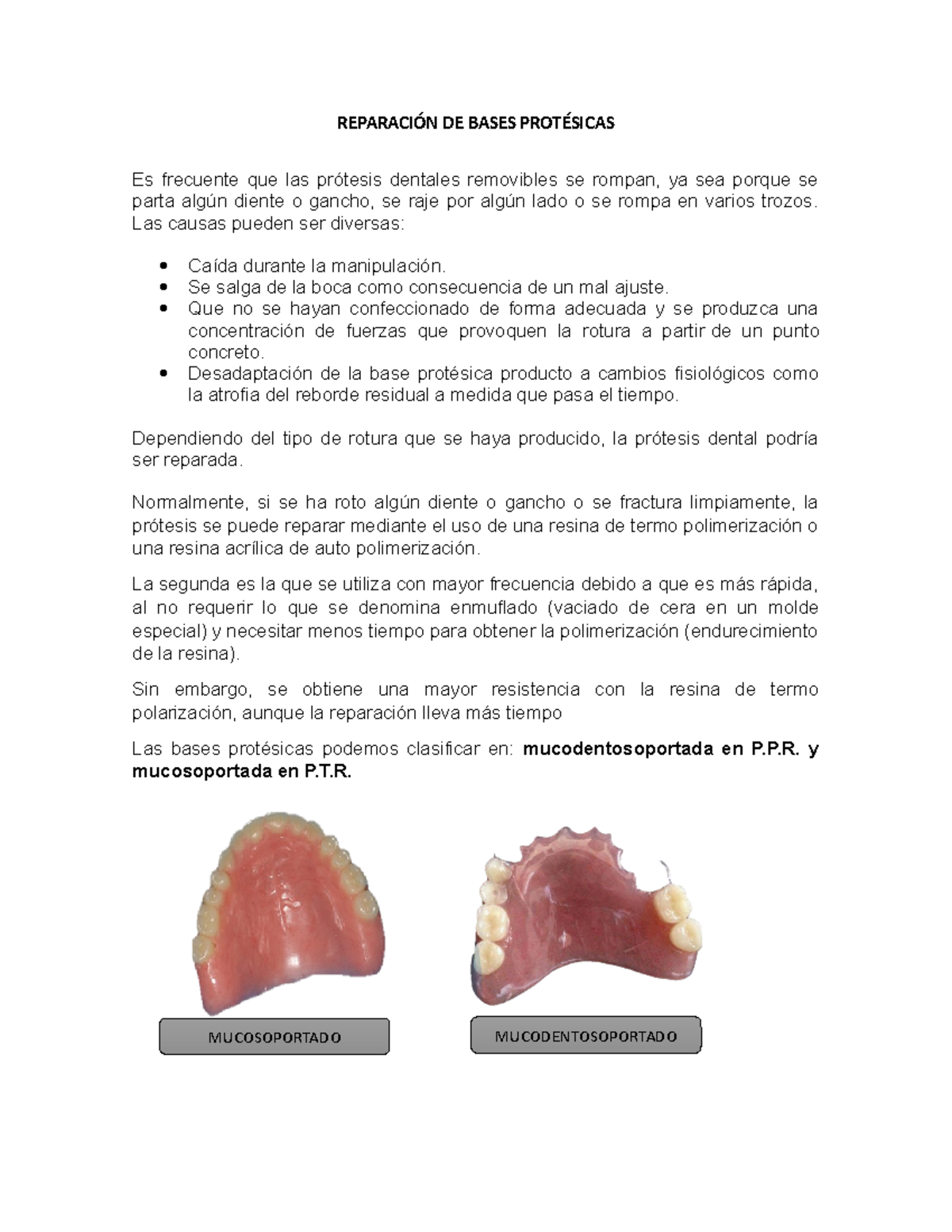 Reparación DE Bases Protésicas - REPARACIÓN DE BASES PROTÉSICAS Es ...