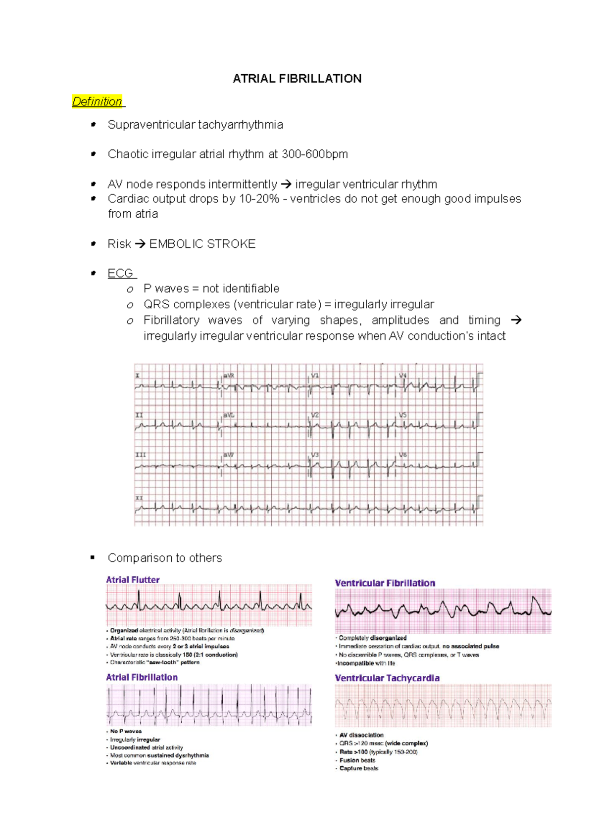 Atrial Fibrillation Lecture notes 14 ATRIAL FIBRILLATION Definition