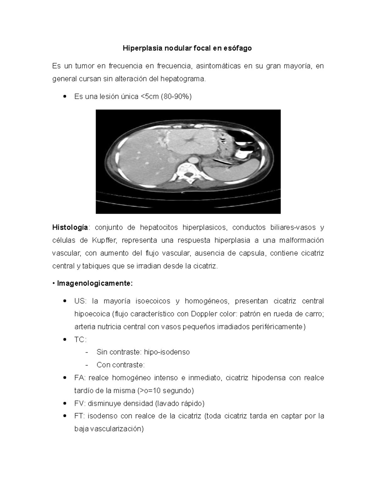 Formación nodular hipoecoica de próstata