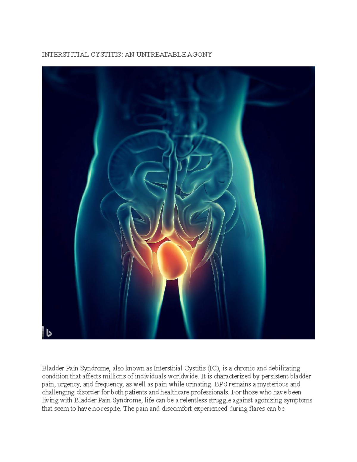 Interstitial Cystitis - It is characterized by persistent bladder pain ...