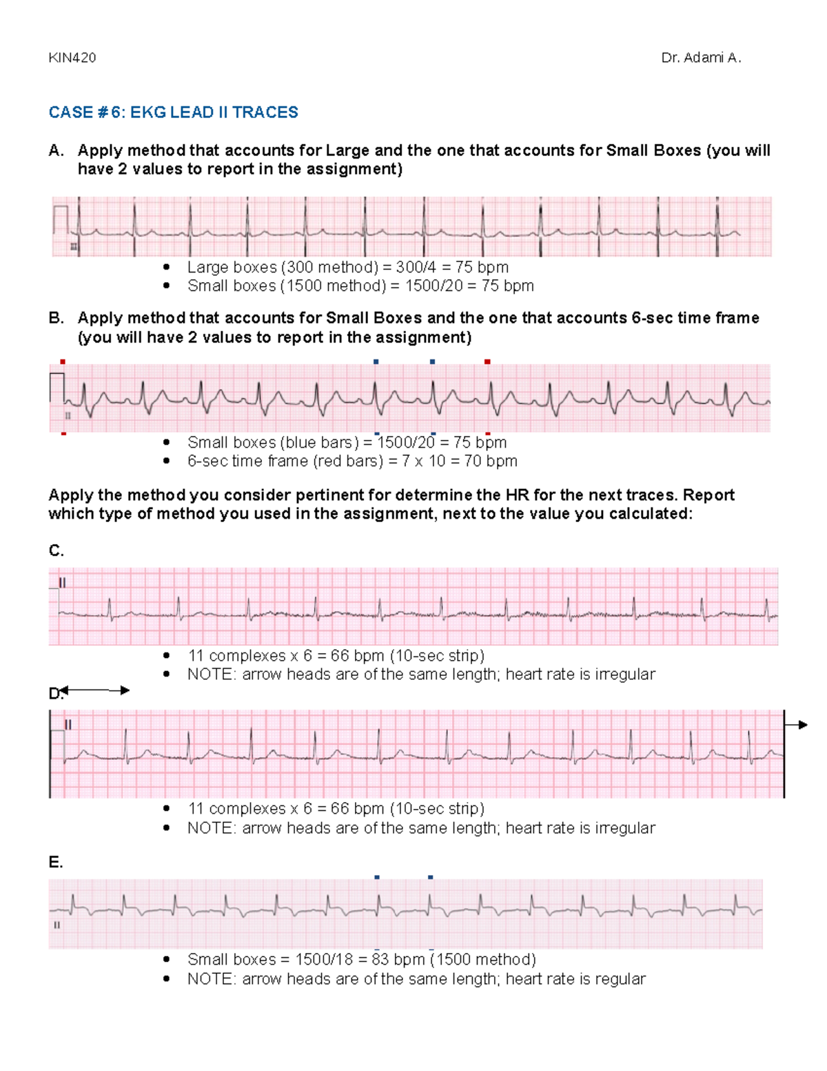 6 Ekg Lead Ii Traces-1 - Cardiopulmonary Testing - Kin420 Dr. Adami A 