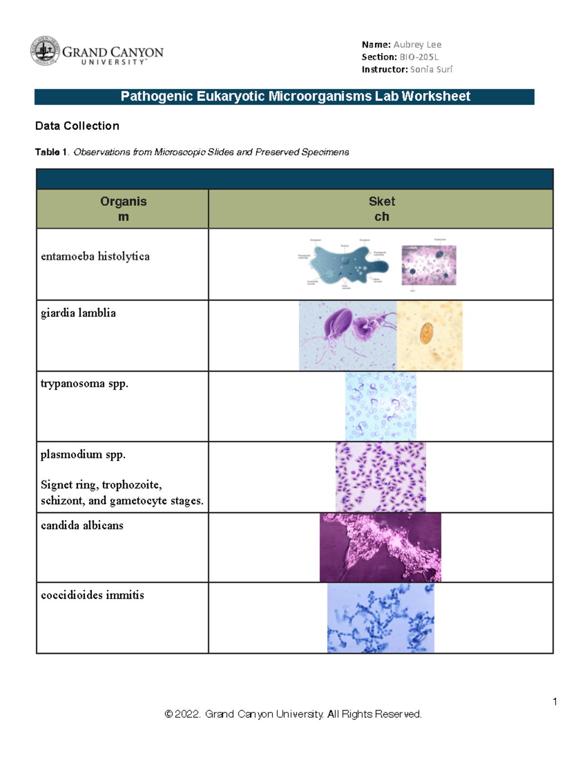 BIO 205L RS Lab13Pathogenic Eukaryotic Microorganisms WS Online