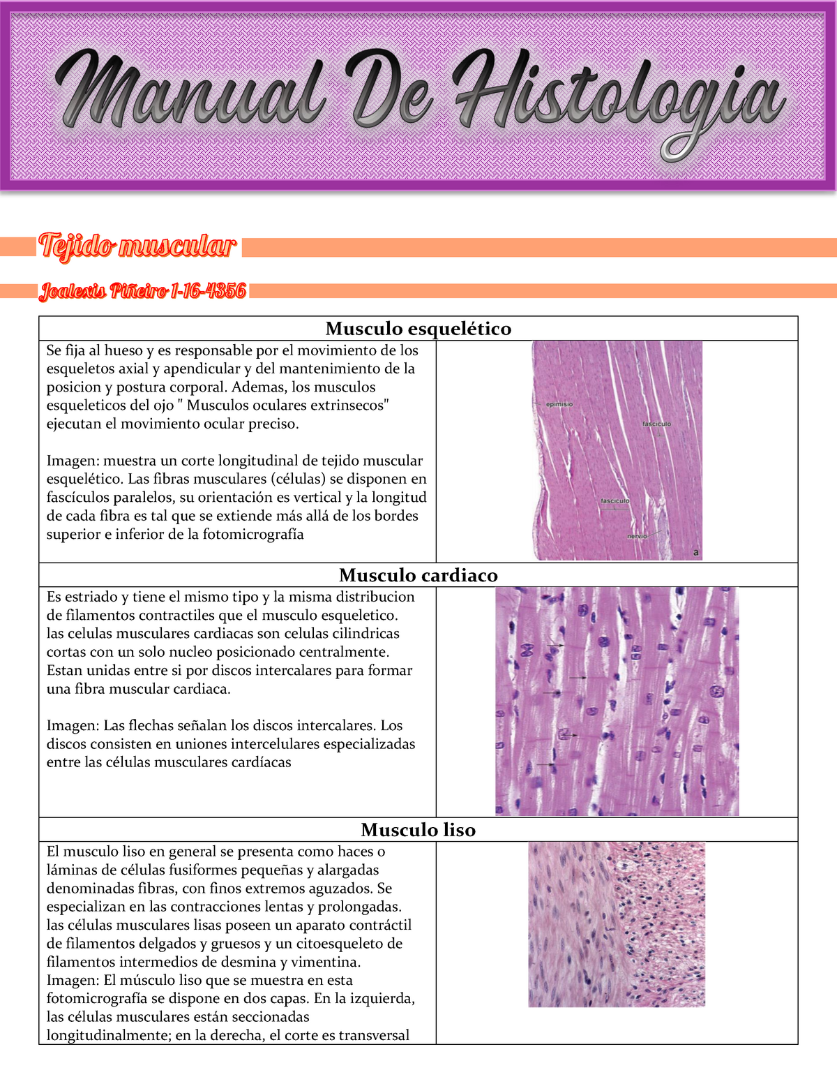 Actriz Trastornado Ardilla Tejido Esqueletico Histologia Noroeste