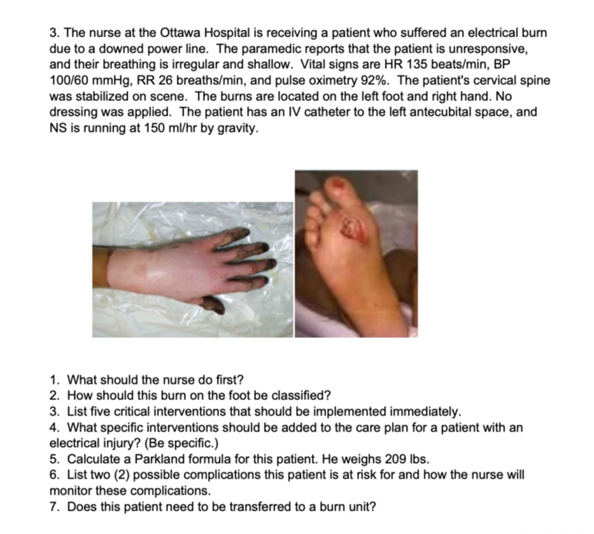 Burns question 1 NSG4330 Studocu
